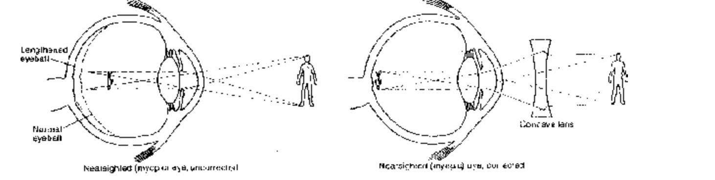 Working Principle of Eye